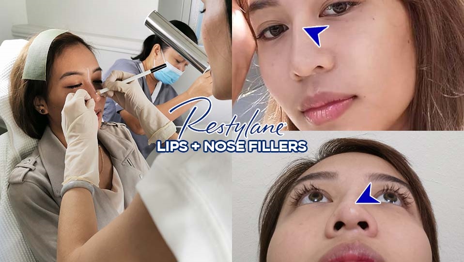 best rhinoplasty surgeons