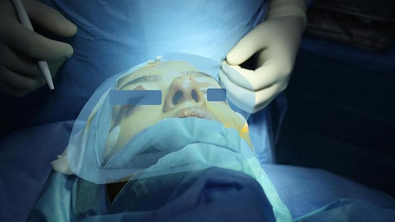 what is a closed rhinoplasty